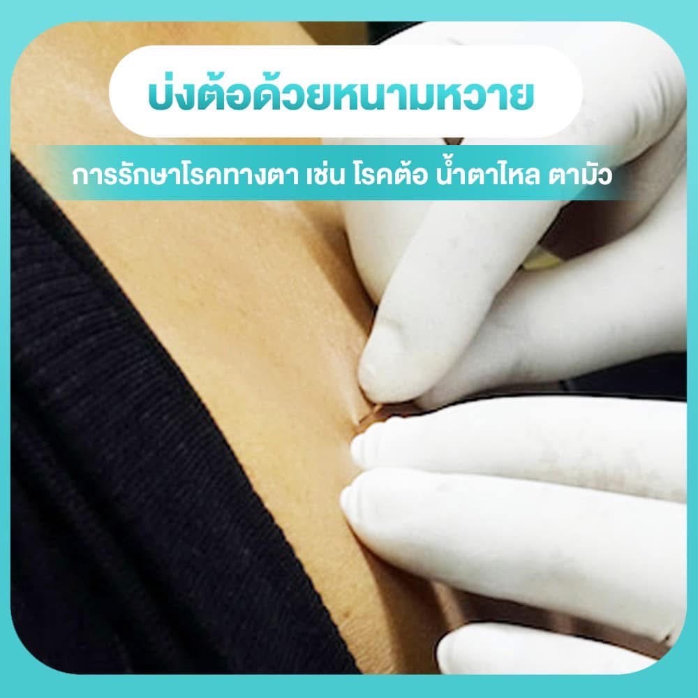 การรักษาโรคทางตา